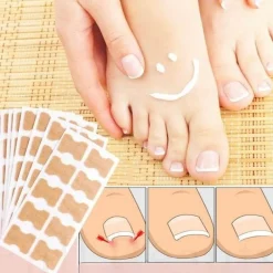 PureGlow Männerpflege|Frauenpflege-Aufkleber zur Korrektur eingewachsener Zehennägel – Behandlung der Zehenausrichtung