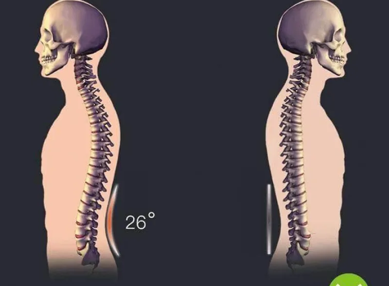 The Relaxation Nook Fitness-Gadgets|Gesundheits-Gadgets-Chiropraktisches Rückenmassagegerät – Magische Schmerzlinderungs-Stretcher