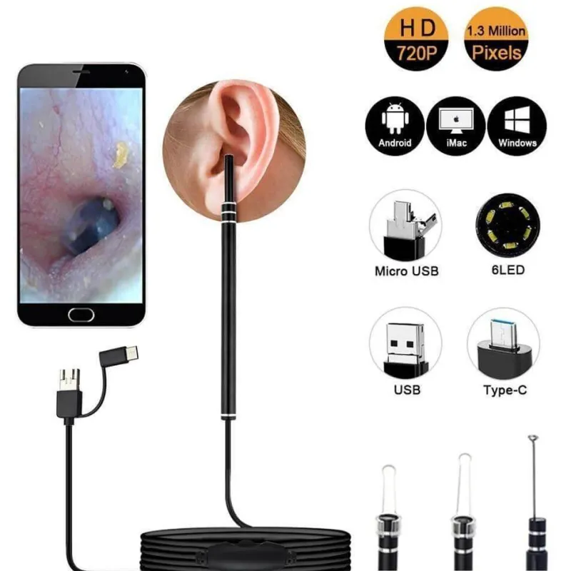 The Relaxation Nook Gesundheits-Gadgets|Gesundheits- Und Entspannungstools-Mini-Ohrreinigungskamera – visuelles Werkzeug zur Ohrenschmalzentfernung