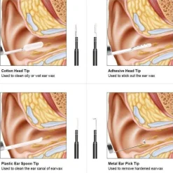 The Relaxation Nook Gesundheits-Gadgets|Gesundheits- Und Entspannungstools-Mini-Ohrreinigungskamera – visuelles Werkzeug zur Ohrenschmalzentfernung