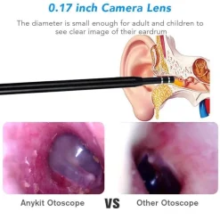 The Relaxation Nook Gesundheits-Gadgets|Gesundheits- Und Entspannungstools-Mini-Ohrreinigungskamera – visuelles Werkzeug zur Ohrenschmalzentfernung