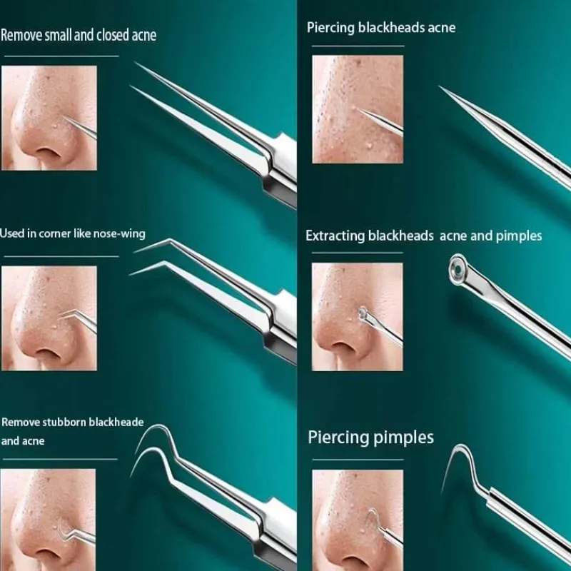 PureGlow Männerpflege|Frauenpflege-Mitesserentferner-Set – Lösung für reine Haut und Akne