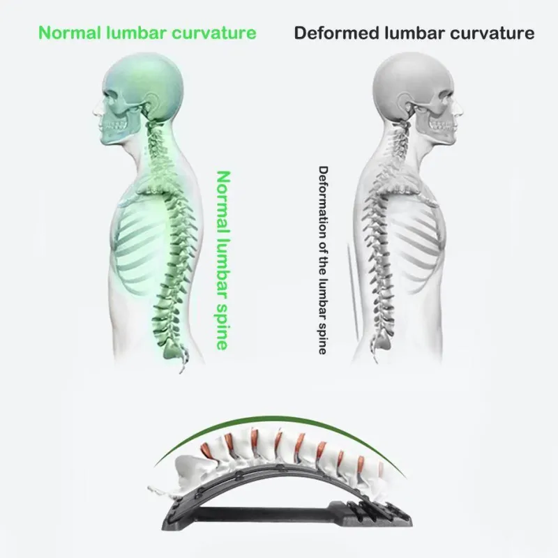 The Relaxation Nook Fitness-Gadgets|Gesundheits- Und Entspannungstools-Rückenschmerzlinderungs-Stretcher - Magisches Wirbelsäulenmassagegerät für Leichtigkeit und Komfort
