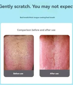 Velvo Care Männerpflege|Frauenpflege-U-förmiger Zungenschaber – Werkzeug zur Entfernung von Mundgeruch