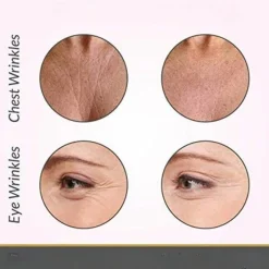 The Relaxation Nook Frauenpflege|Körperpflege-Wiederverwendbare Anti-Falten-Pads aus Silikon – Hautpflegebehandlung