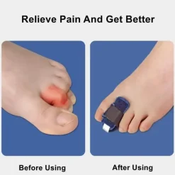 The Relaxation Nook Gesundheits-Gadgets|Gesundheits- Und Entspannungstools-Zehenkorrektor – Sanfte Fußstabilisierungsunterstützung