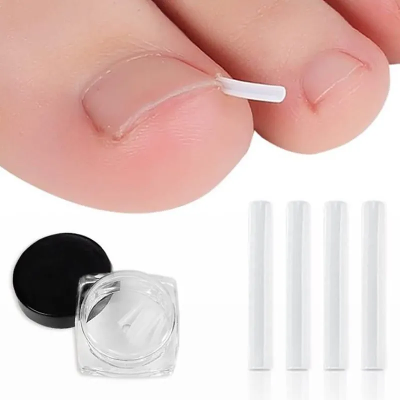 The Relaxation Nook Gesundheits-Gadgets|Gesundheits- Und Entspannungstools-Zehennagel-Stützpolster – Komfortkissen zur Linderung von Zehennagelschmerzen