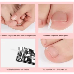 The Relaxation Nook Gesundheits-Gadgets|Gesundheits- Und Entspannungstools-Zehennagel-Stützpolster – Komfortkissen zur Linderung von Zehennagelschmerzen