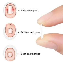 The Relaxation Nook Gesundheits-Gadgets|Gesundheits- Und Entspannungstools-Zehennagel-Stützpolster – Komfortkissen zur Linderung von Zehennagelschmerzen